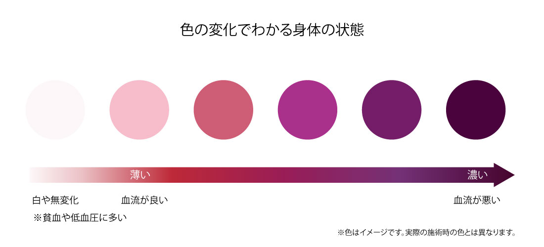 吸い玉色の変化