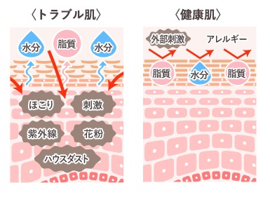 赤ちゃんが泣きやまない