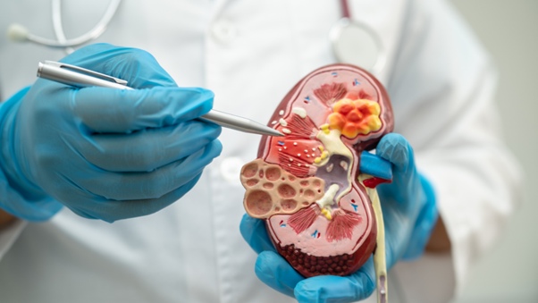 血尿が出る仕組みと原因の大きな分け方