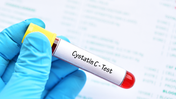 シスタチンCとは？まず知っておきたいこと