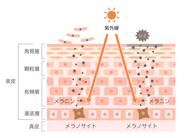 シミ予防するには