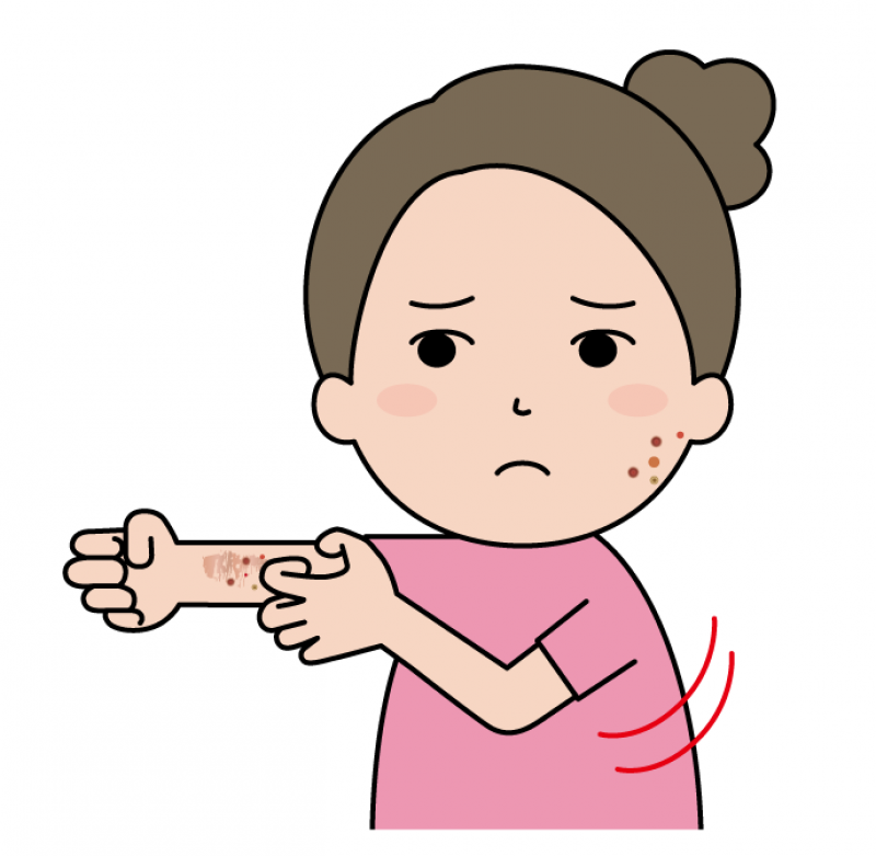 アレルギー性疾患
元々アレルギーで反応が出やすく、特に新薬を飲むと全身の痒み、耳漏、胸の痛みが出る。クーラーで手足が冷えることもありそれらの諸症状を良くなりたいと思い来店。
漢方を続けて半年で皮膚の痒みは無くなり、現在は鍼灸で再発防止に取り組んでいます。
H.Kさん　67歳