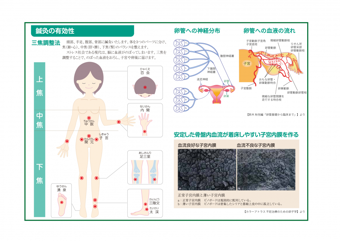妊活と鍼灸