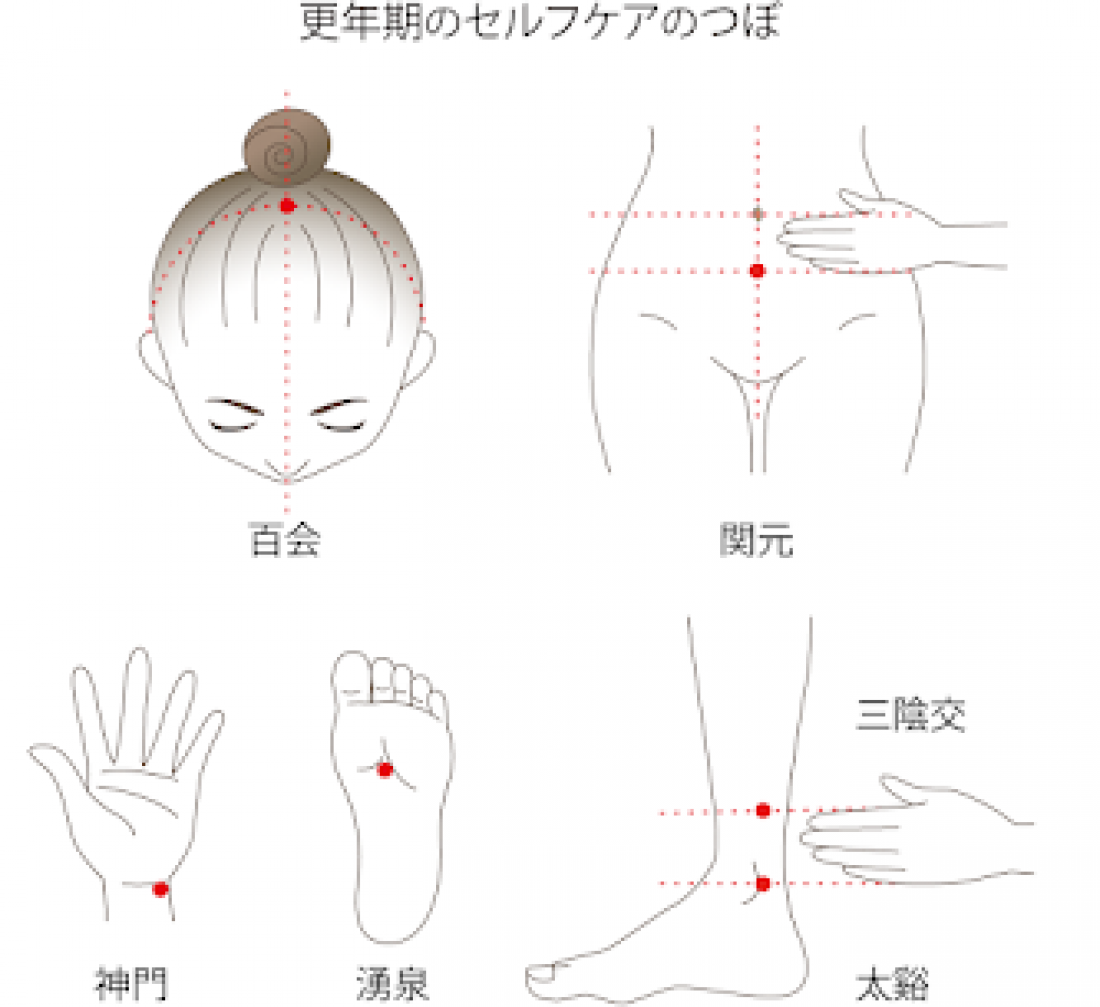 津田沼で更年期障害の鍼灸ケア｜体質に合わせた中医学的アプローチ