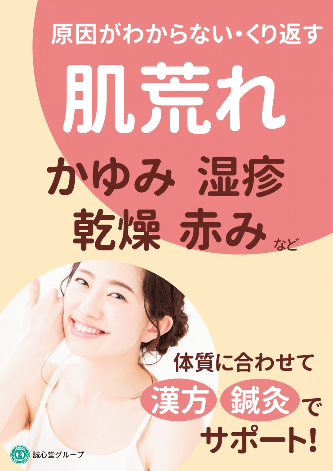 【症例紹介】長年のニキビ・赤ら顔（酒さ）が漢方で改善した45歳女性のケース