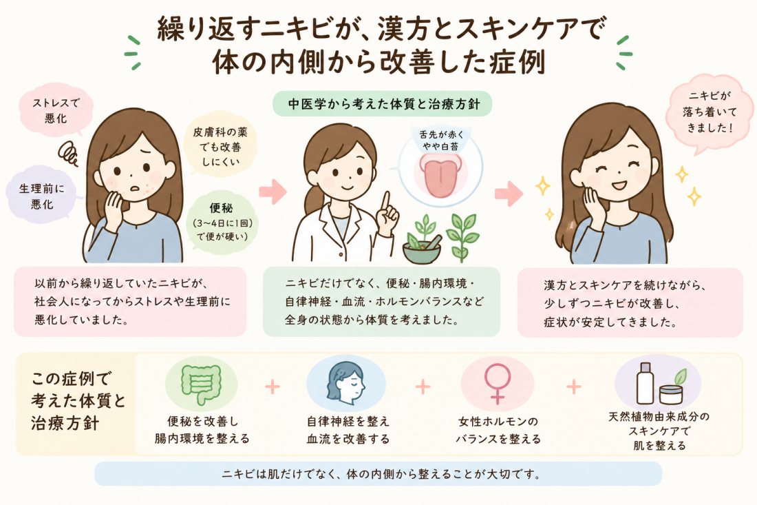 【千葉・習志野市】生理前に悪化するニキビを漢方で体質改善|誠心堂薬局 津田沼店