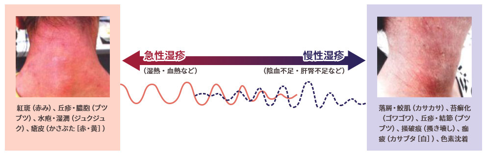 皮膚トラブル改善の3ステップ