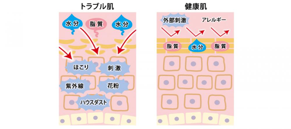 乾燥肌 | 皮膚疾患｜漢方と鍼灸 株式会社誠心堂薬局