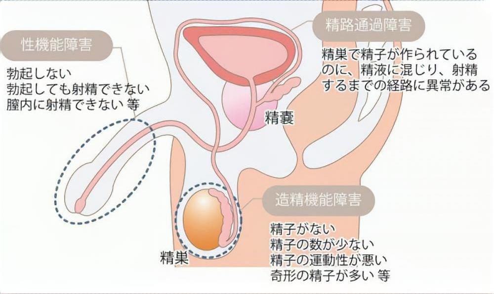 男性不妊 病名 症状一覧 漢方と鍼灸 株式会社誠心堂薬局