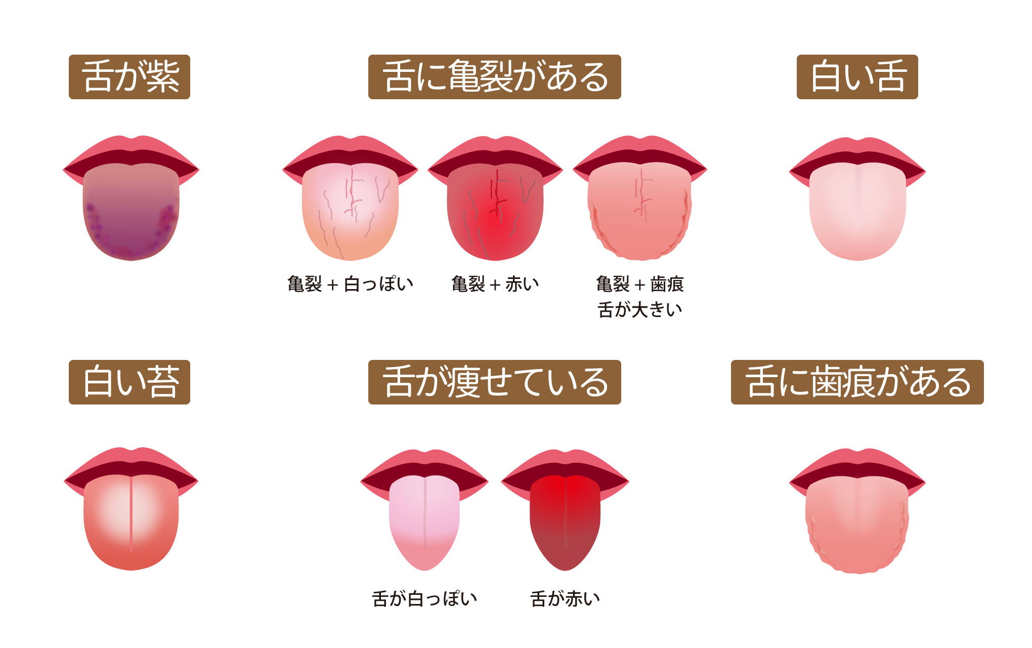 歯科医に連絡する