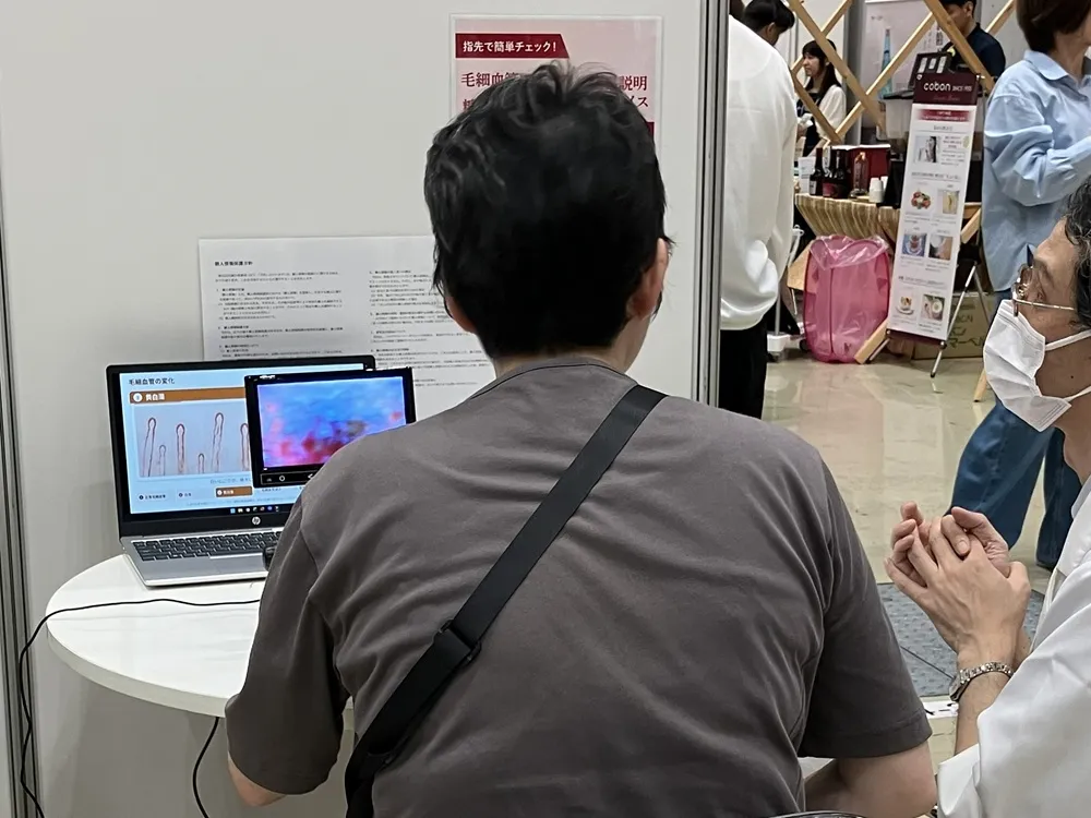 血管観察機器による毛細血管の状態確認